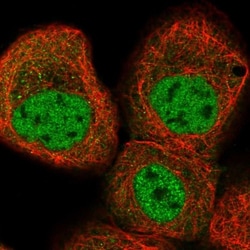 KLHDC10 Antibody, Novus Biologicals:Antibodies:Primary Antibodies